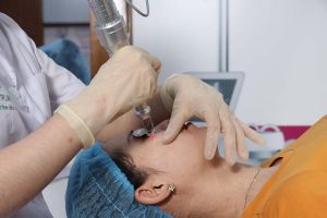 Địa chỉ trị sẹo ở hà nội