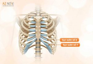 Nâng mũi sụn tự thân: Tổng hợp các loại sụn tự thân thông dụng