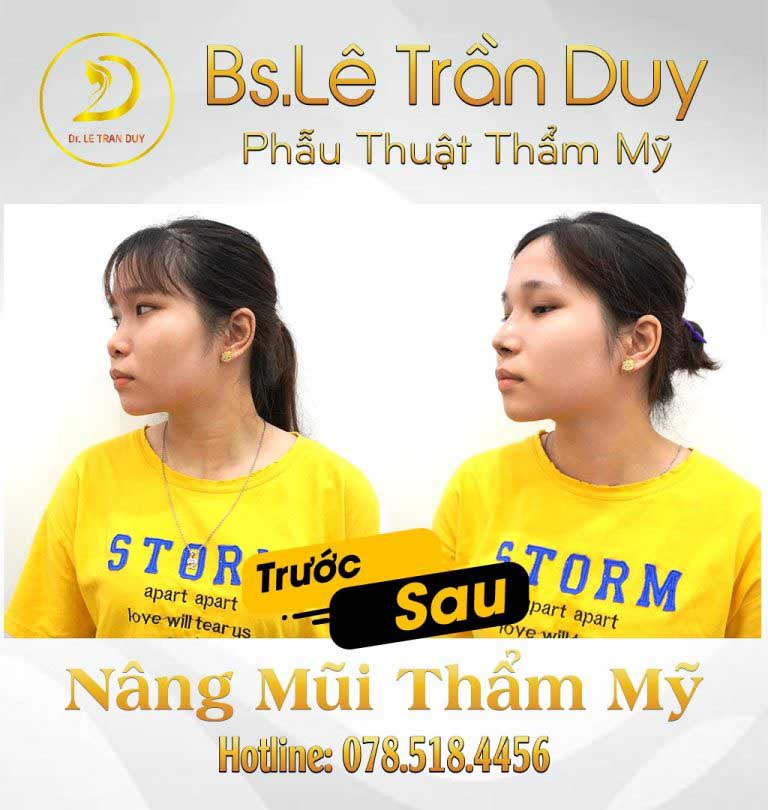 Review bác sĩ Lê Trần Duy