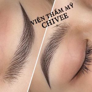 thẩm mỹ viện chivee