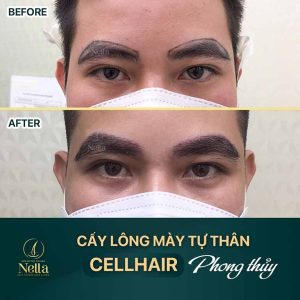 địa chỉ cấy lông mày tại tphcm