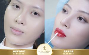 cơ sở phun xăm thẩm mỹ an toàn tại Cần Thơ