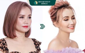 địa chỉ thẩm mỹ viện nâng mũi uy tín tại đà nẵng