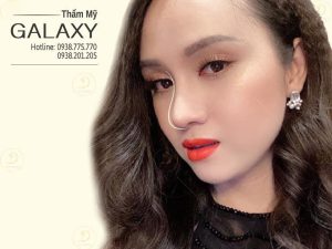 địa chỉ nâng mũi trả góp TPHCM