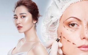 Cơ sở thẩm mỹ viện uy tín tại TP Pleiku