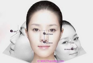 Nâng mũi A-Shape là gì? Hiệu quả không? Giá bao nhiêu