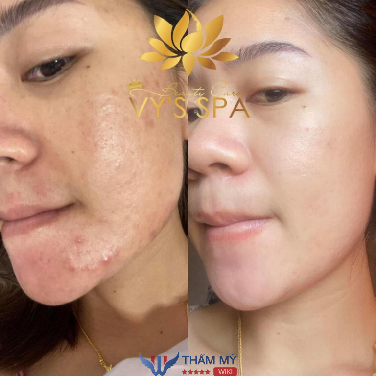Vy’s Spa ở Bà Rịa Vũng Tàu 