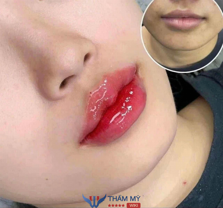 Spa Nam Dương  ở Tân Uyên