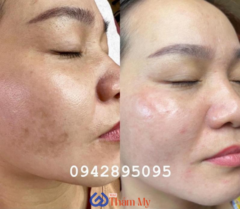 Sài Gòn Xinh Spa ở Tuyên Quang 