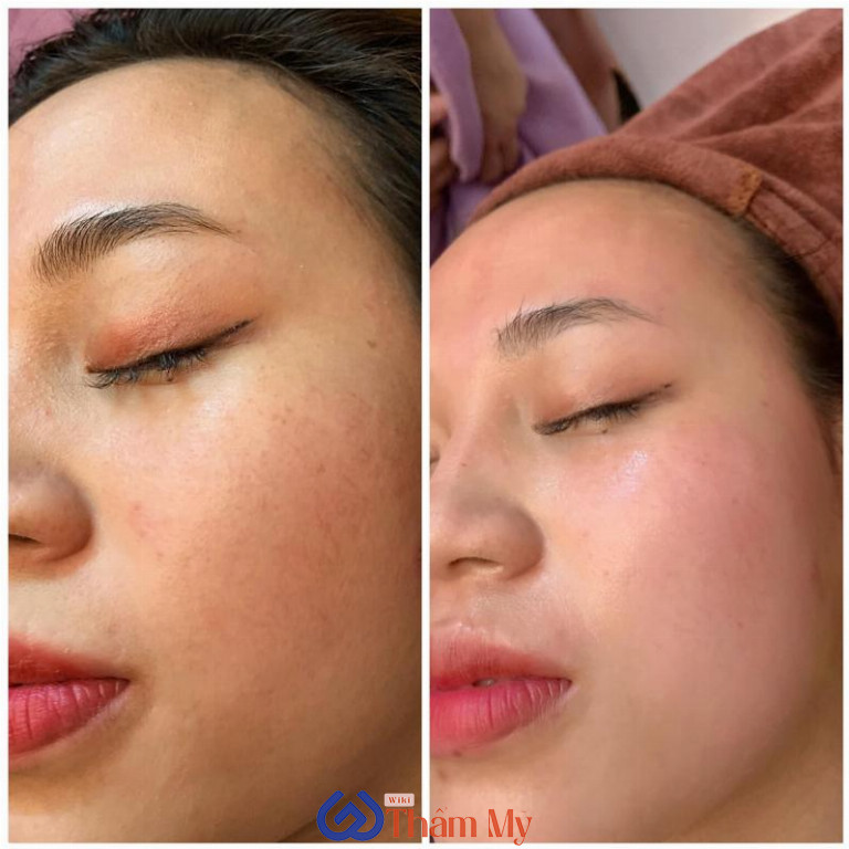 Hương Bùi Spa ở Tuyên Quang 