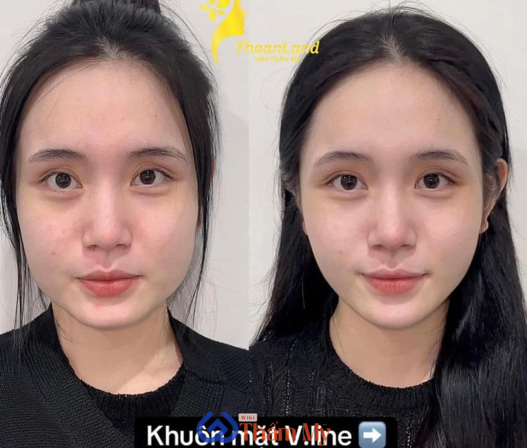 Thẩm mỹ viện tại Bình Định ThoanLand