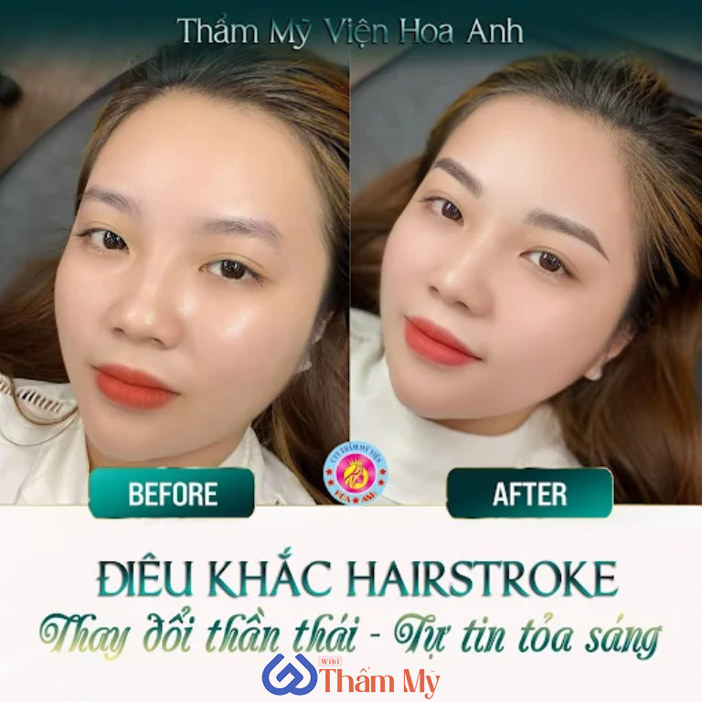 Thẩm Mỹ Viện Hoa Anh ở Gò Công