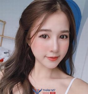 Có nên nâng mũi khi bị viêm xoang không? Bác sĩ giải đáp