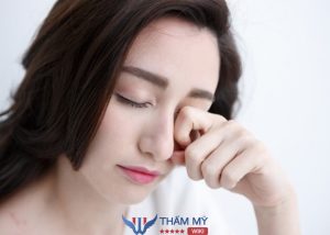 Mắt bị sụp mí có cắt, nhấn mí được không? Chuyên gia tư vấn