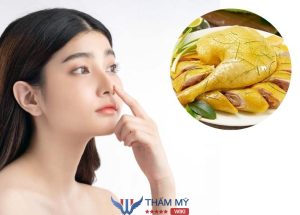 Nâng mũi ăn thịt gà, thịt vịt được không? Kiêng đến khi nào thì được?