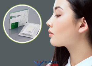 Nâng Mũi Cấu Trúc Megaderm: Ưu điểm và những thông tin cần biết