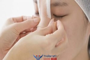 Nâng mũi mấy ngày tháo băng? Cắt chỉ có đau không?