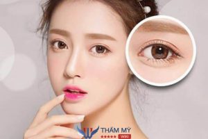 Nhấn mí Hàn Quốc: Kiến tạo đôi mắt đẹp tự nhiên, hoàn hảo