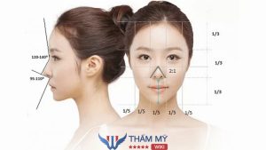 Những dáng mũi không nên sửa kẻo hối hận không kịp