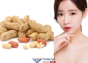 Sau khi nâng mũi ăn đậu phộng được không? Giải đáp của bác sĩ