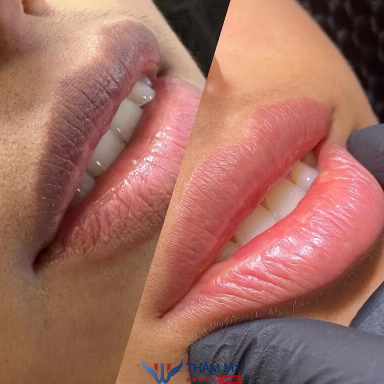 Hillary Beauty spa làm đẹp ở Quận Lê Chân 