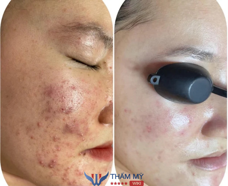 Spa Lệ Quyên Beauty academy ở Quận Ngô Quyền