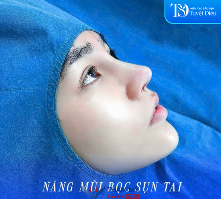 Thẩm Mỹ Viện Tuyệt Diệu