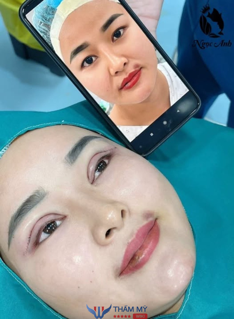 Thẩm Mỹ Ngọc Anh