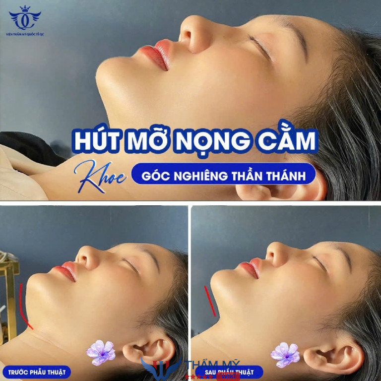 Thẩm mỹ viện ở Quận Hải Châu uy tín
