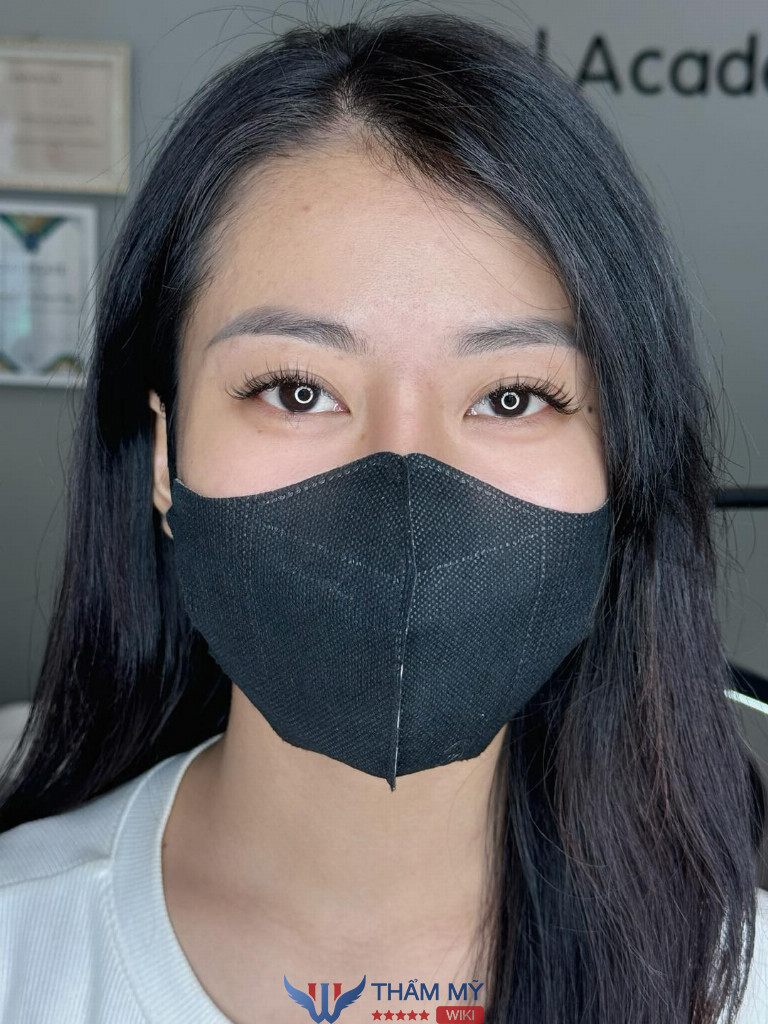 Nối Mi Thủ Đức Thảo Nguyễn
