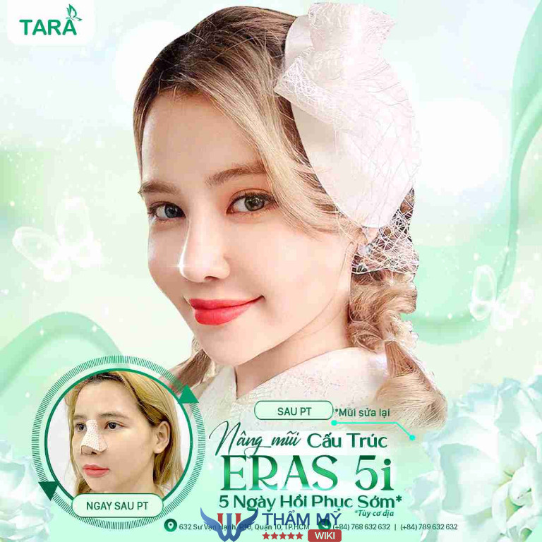 Thẩm mỹ mũi tại Bác sĩ Trang 