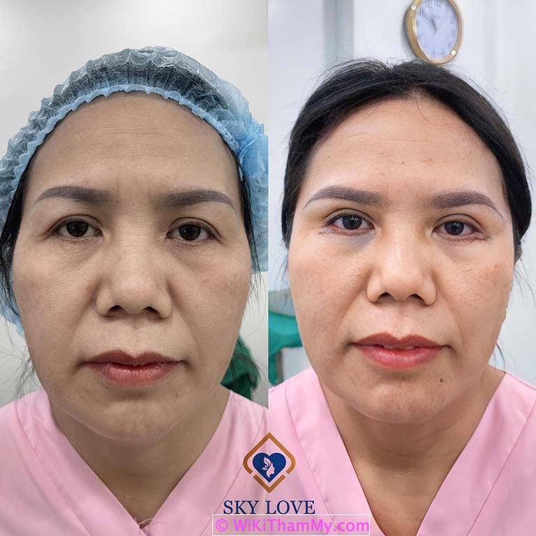 dịch vụ thế mạnh của bác sĩ Trần Ngô Phúc Quân