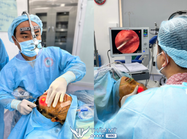 căng da mặt nội soi tại PGS.TS.BS Phạm Hiếu Liêm