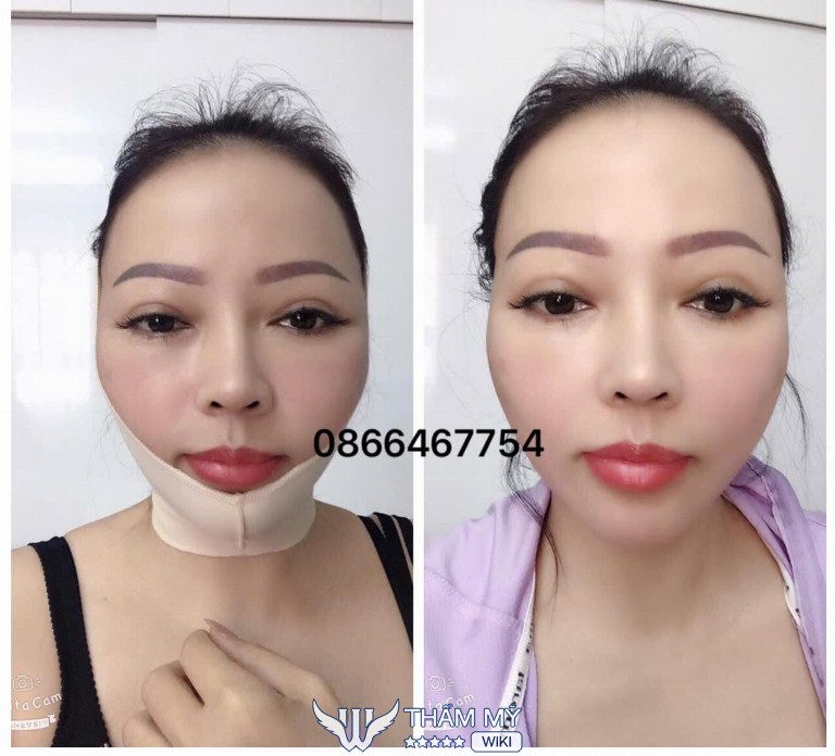 Ths Bs Nguyễn Quốc Việt bệnh viện Giao Thông Vận Tải TPHCM