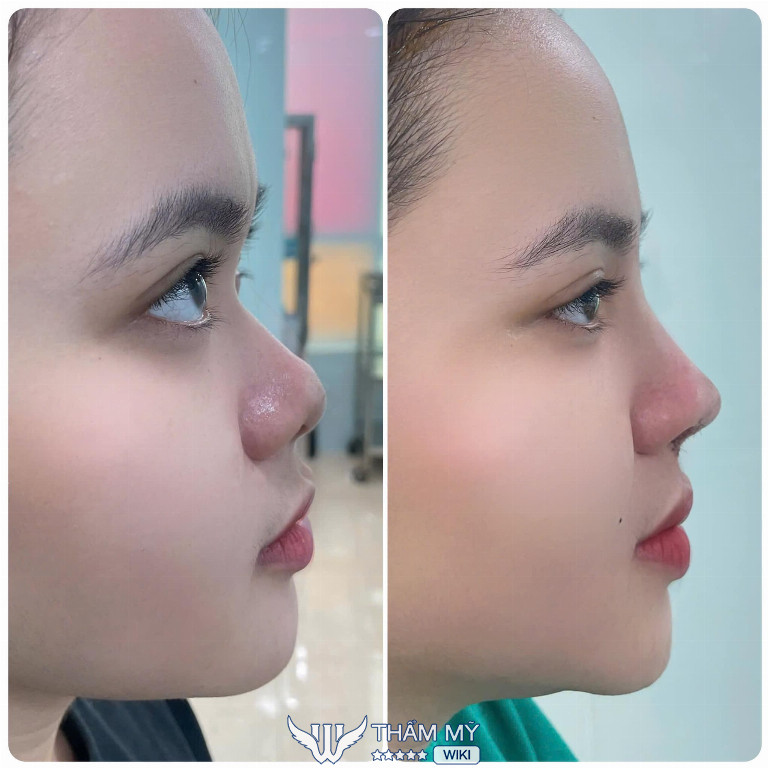 thẩm mỹ viện thiên kim bs Phan Thành Tự reviews