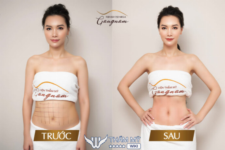 Thẩm mỹ viện Mega Gangnam, Đà Nẵng