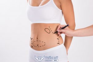 11 Địa chỉ hút mỡ bụng tại TPHCM uy tín, nổi tiếng