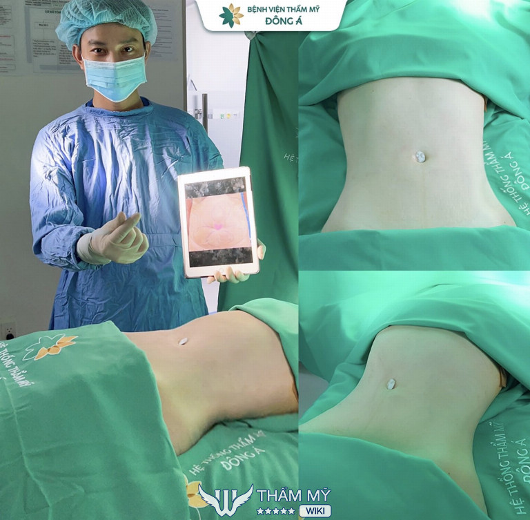 Bệnh viện thẩm mỹ Đông Á - Hút mỡ giảm béo toàn thân uy tín tại TPHCM