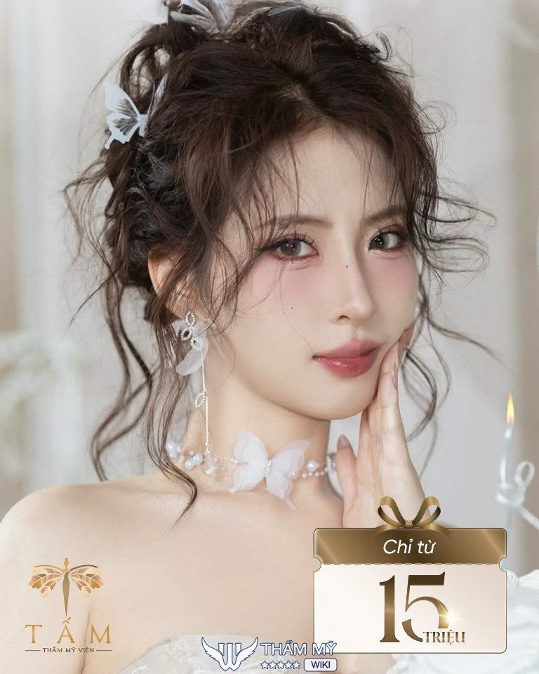 Nâng mũi ở đâu uy tín tại Hà Nội? Thẩm mỹ viện Tấm