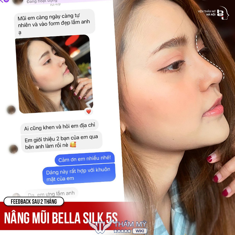 Cơ sở nâng mũi uy tín tại Hà Nội - Viện thẩm mỹ Hà Nội