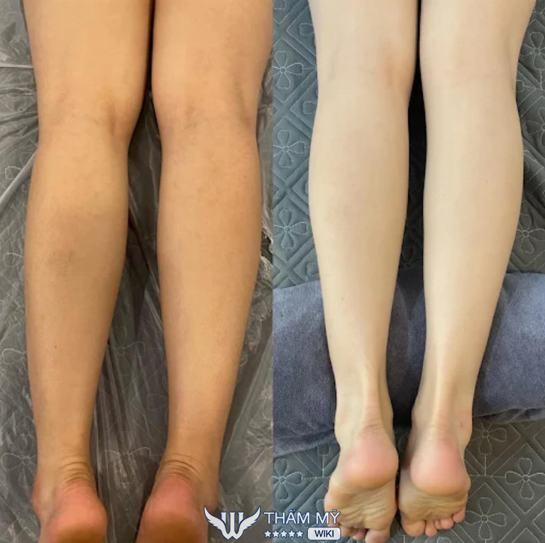 Địa chỉ tắm trắng ở Đà Nẵng - Khánh Ly Beauty & Clinic