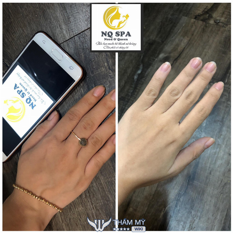 NQ Spa tắm trắng ở Đà Nẵng