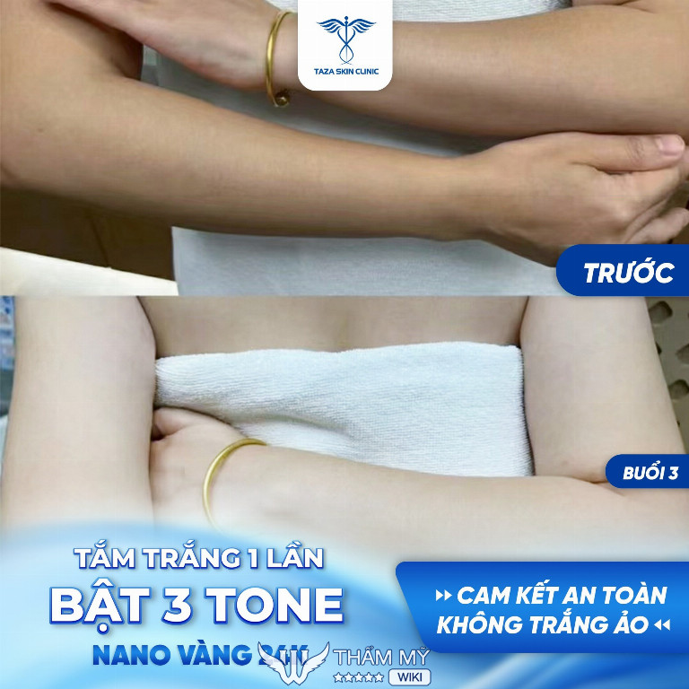 Taza Skin Clinic - Địa chỉ tắm trắng uy tín ở Đà Nẵng