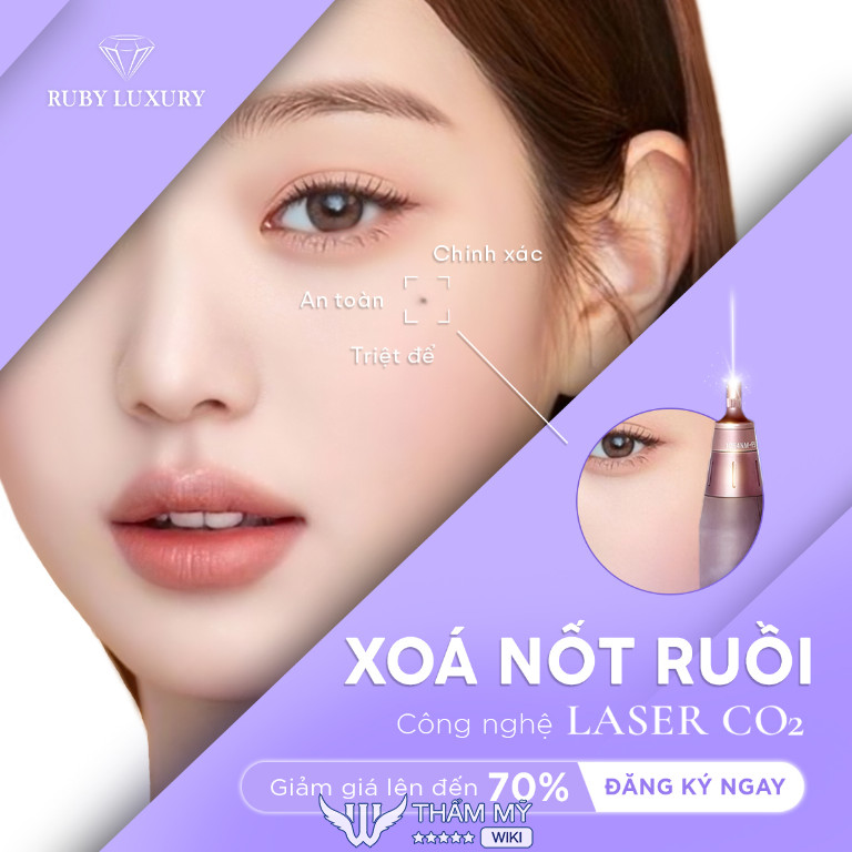 Địa chỉ tẩy nốt ruồi ở Thanh Hóa - Phòng Khám Da Liễu Thẩm Mỹ Ruby Luxury