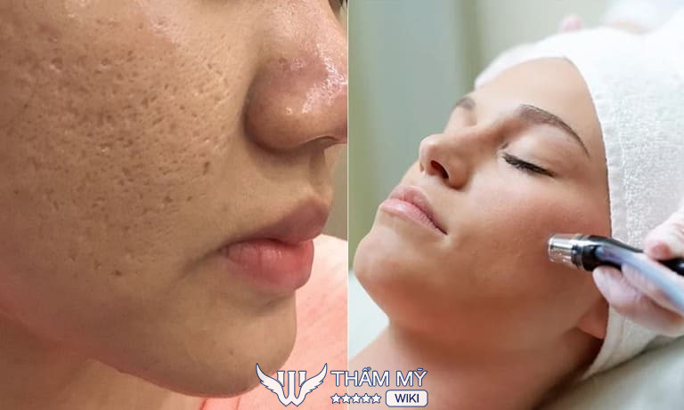 La Rosa & Spa, Hải Phòng