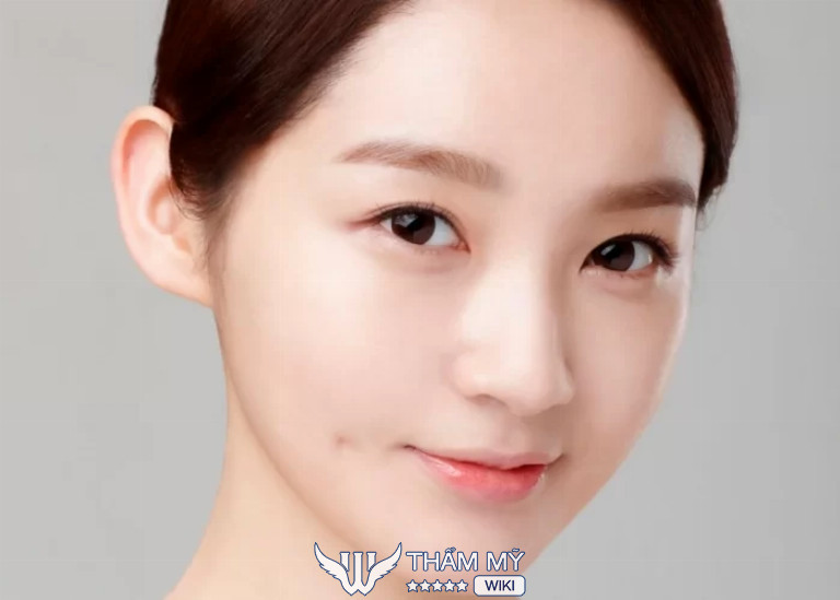 Làm má lúm đồng tiền ở đâu đẹp tại TPHCM? Bệnh viện thẩm mỹ Worldwide