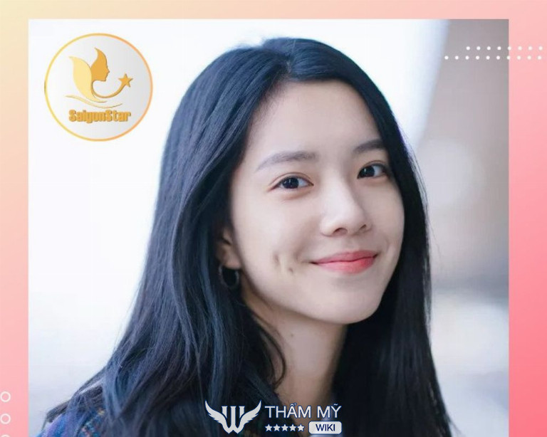 Địa chỉ tạo má lúm đồng tiền ở TPHCM đẹp và uy tín - Trung Tâm Thẩm Mỹ Saigon Star