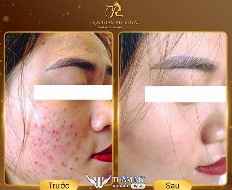 Royal Spa, Hải Phòng