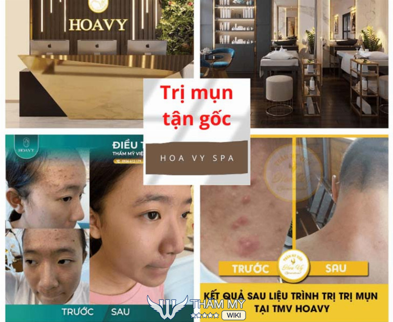 Hoa Vy Spa, Hải Phòng