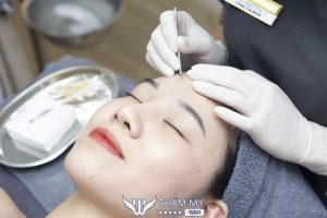 10 Spa trị mụn tại Huế uy tín, hiệu quả nhất hiện nay